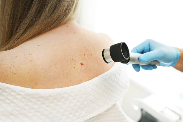 a-dermatologist-examines-moles-and-skin-growths-on-the-patients-body-using-a-special-device-a2148512282